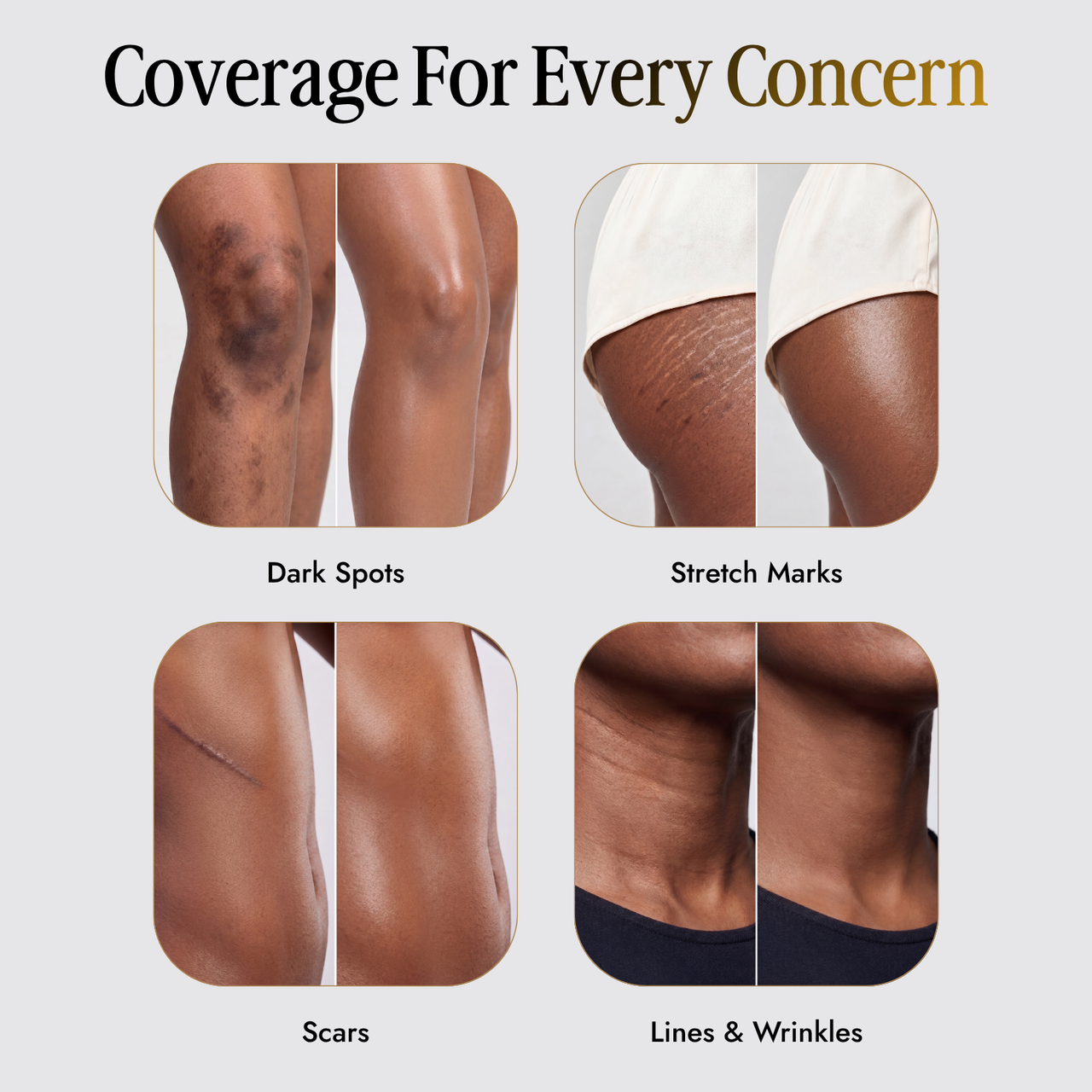 Trelia™ Coverage Perfector