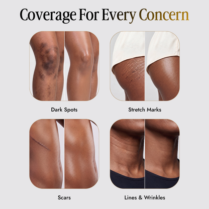 Trelia™ Coverage Perfector
