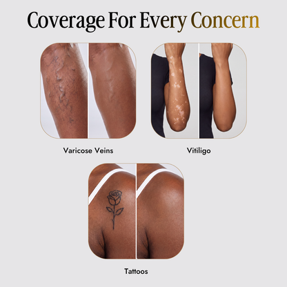 Trelia™ Coverage Perfector