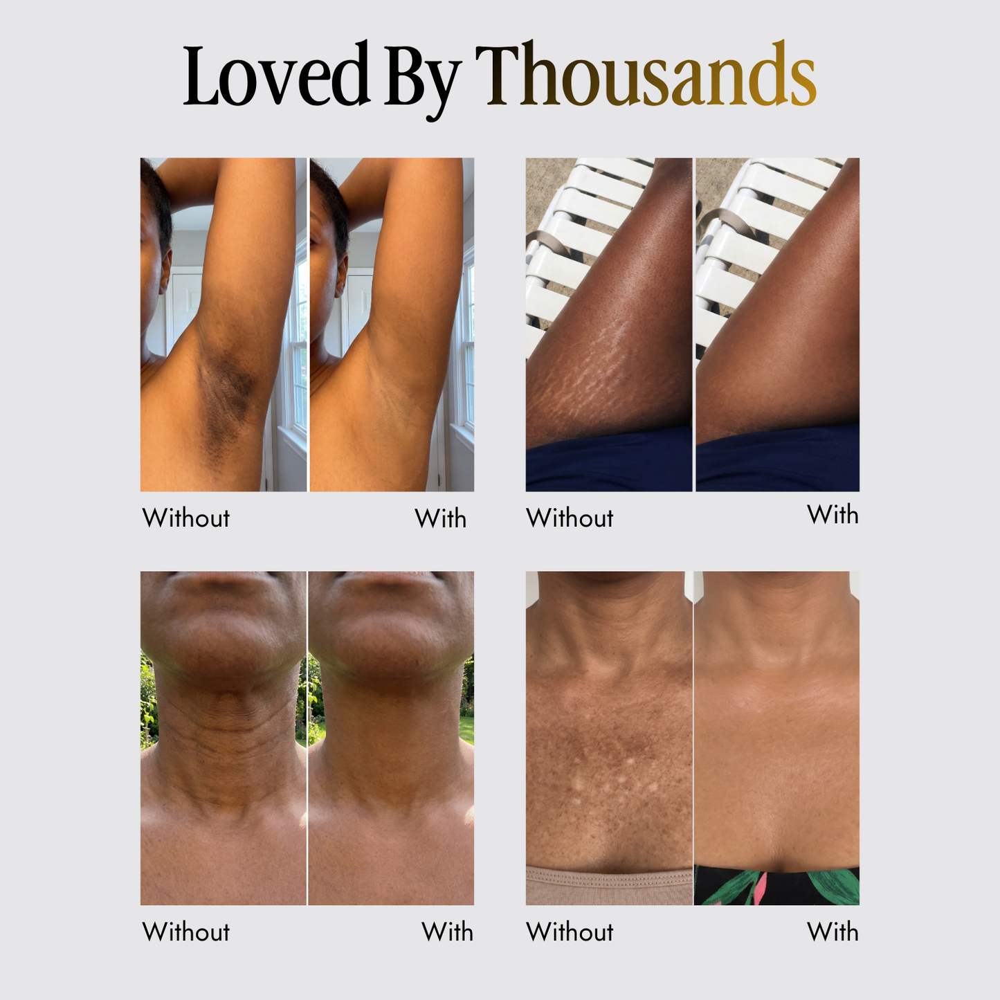 Trelia™ Coverage Perfector
