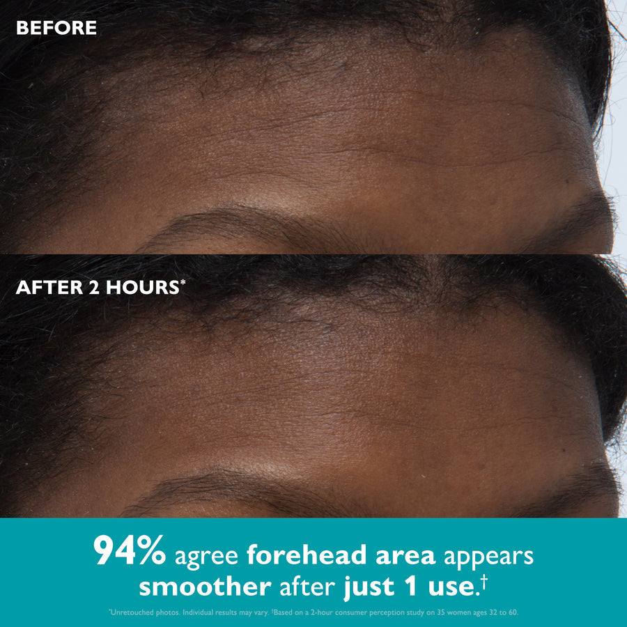 Trelia™ Eye Tape
