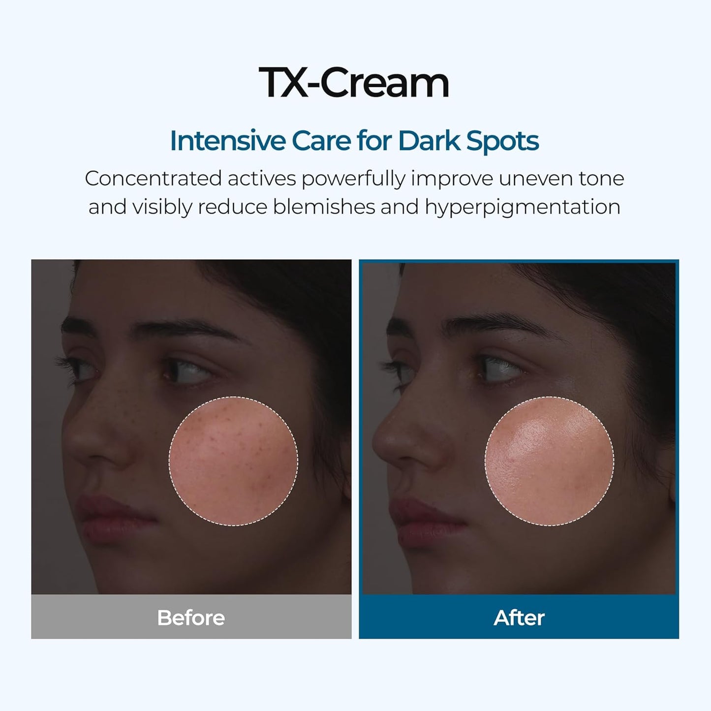 Trelia™ Brightening Cream