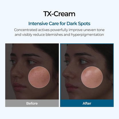 Trelia™ Brightening Cream
