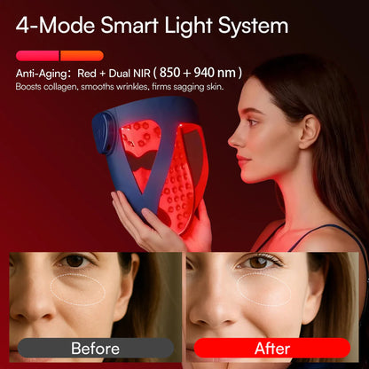 Trelia™ Red Light Mask